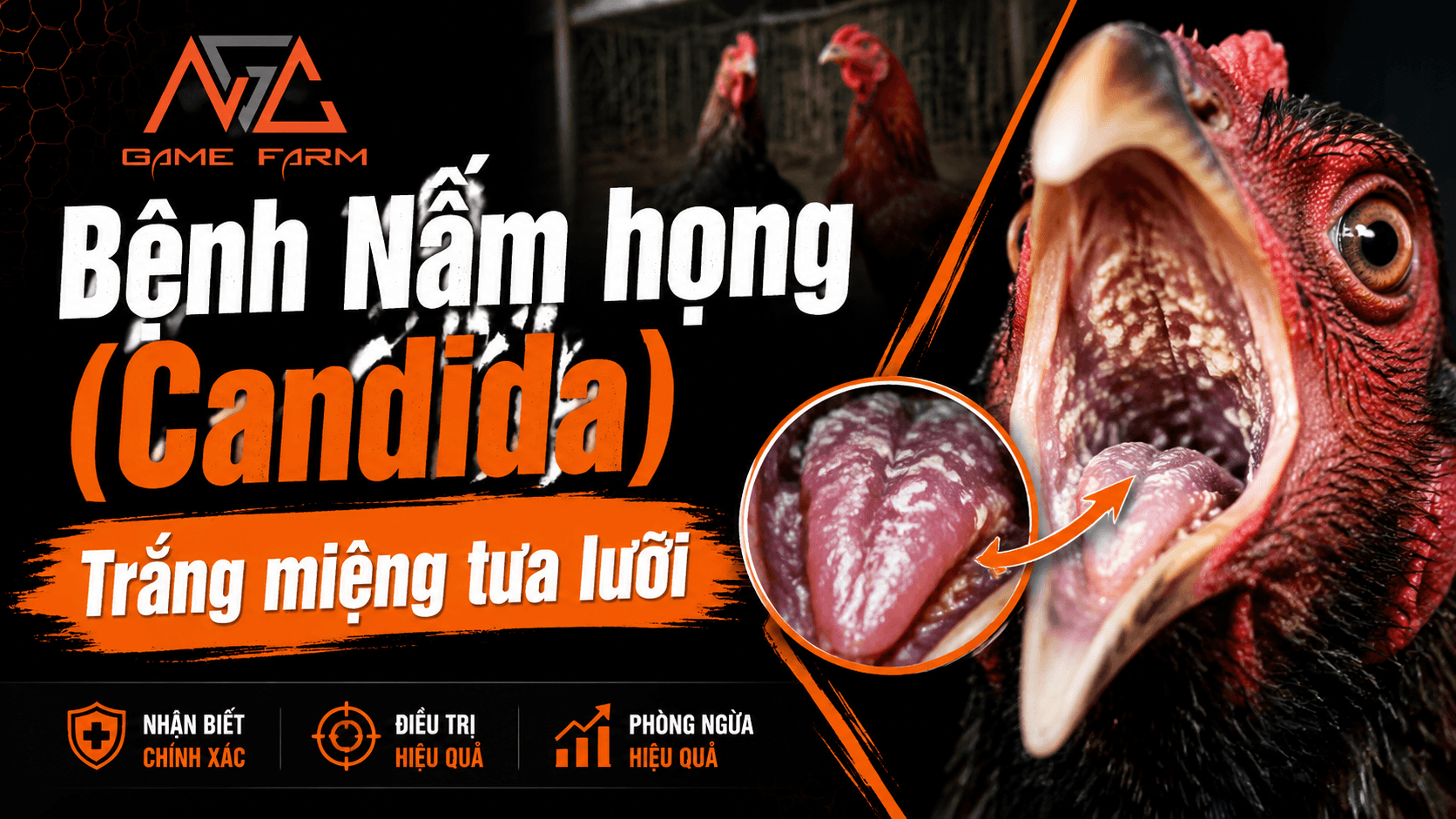 Bệnh Nấm Họng Gà: Nguyên Nhân, Triệu Chứng và Phác Đồ Trị Dứt Điểm